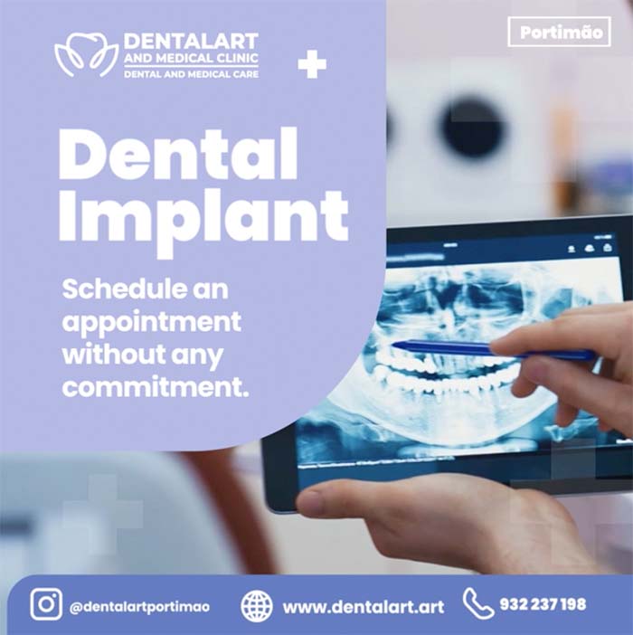 Dental Inplant Social Media Ad